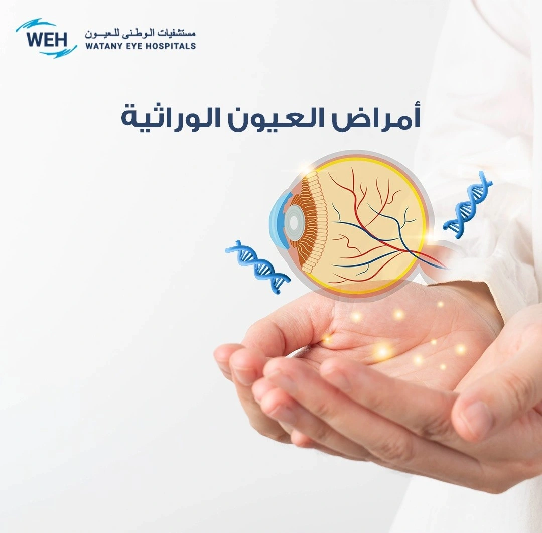 أمراض العيون الوراثية: ما تحتاج إلى معرفته