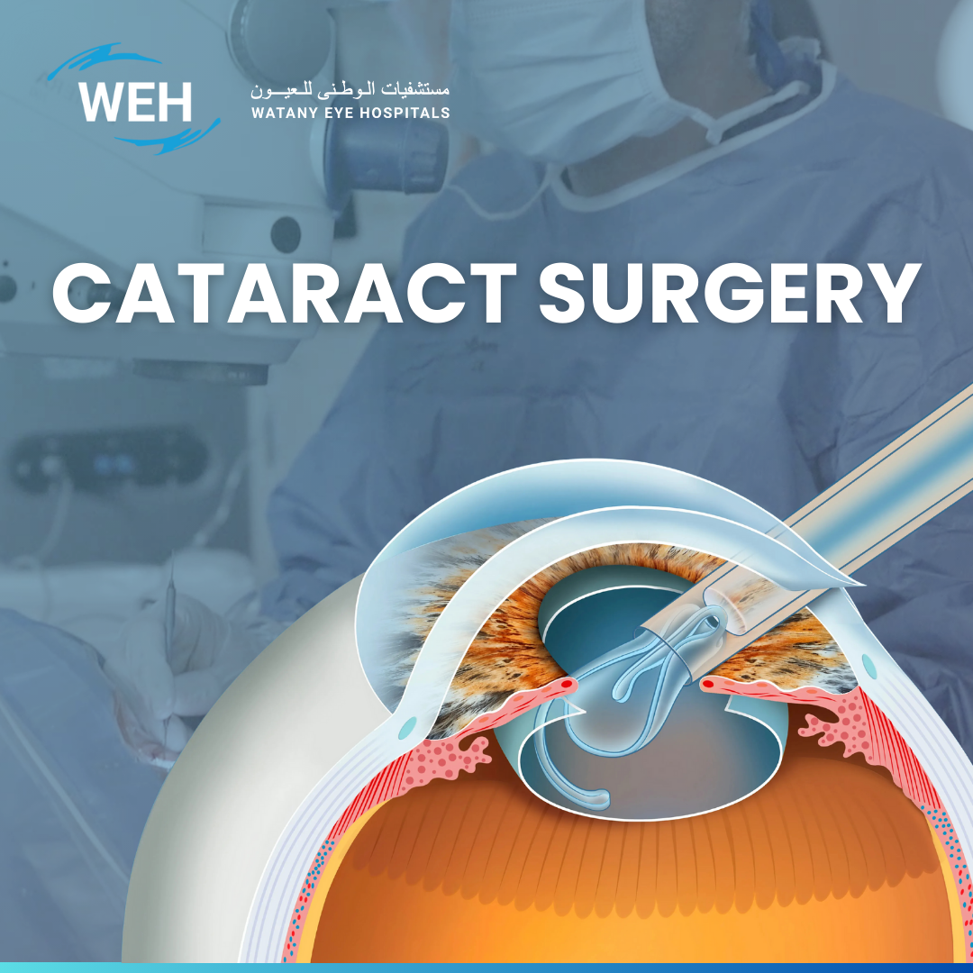 Catarct Surgery